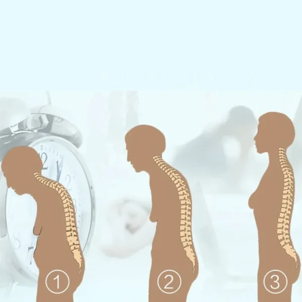 Advanced Posture Corrector – Ergonomic Support for a Confident, Pain-Free Back